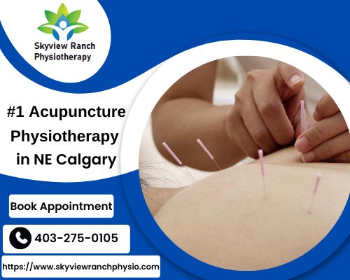 Acupuncture Calgary