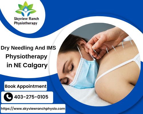 Dry Needling And IMS Therapy in Calgary