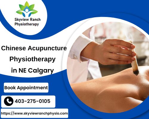 Chinese Acupuncture in Calgary