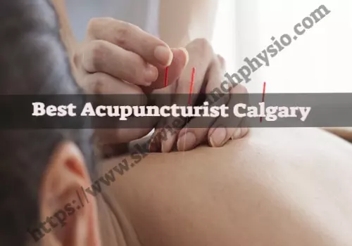 best acupuncturist calgary