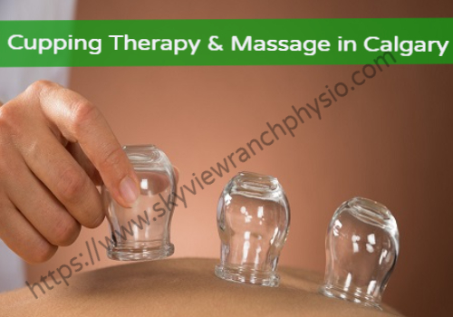 cupping therapy in calgary